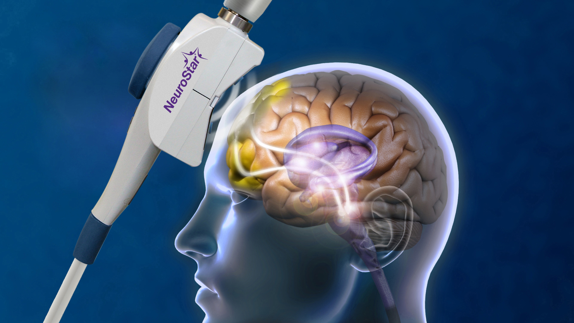 TMS Therapy at Essential Psychiatry