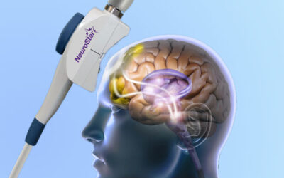 How Does NeuroStar TMS Therapy Spokane Transform Mental Health?