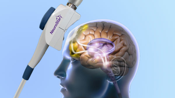 How Does NeuroStar TMS Therapy Spokane Transform Mental Health?